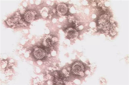 影响哺乳仔猪腹泻的因素及防治措施，养猪人必读！