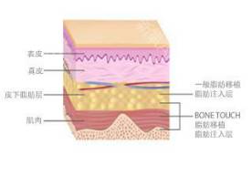 给猪打针还鼓包？你肯定没做到这两点