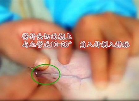 仔猪耳静脉推注，学一招江湖救急！