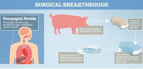 英国开创全球首例！用“猪器官”来治疗人类出生缺陷