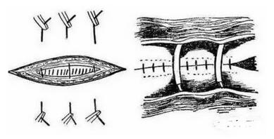 经典!教你如何在猪疝气和外伤时如何做好缝合