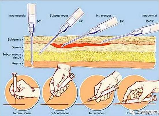一图看懂 四种注射方式