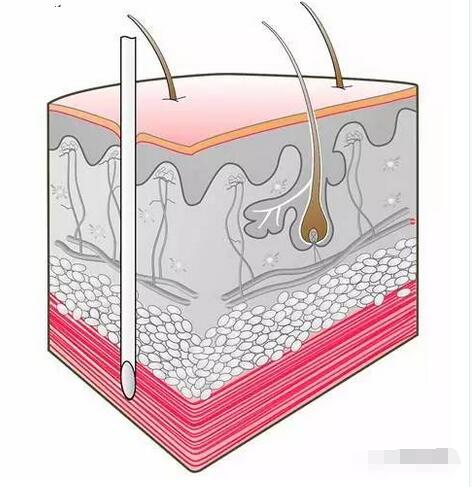 一图看懂 四种注射方式