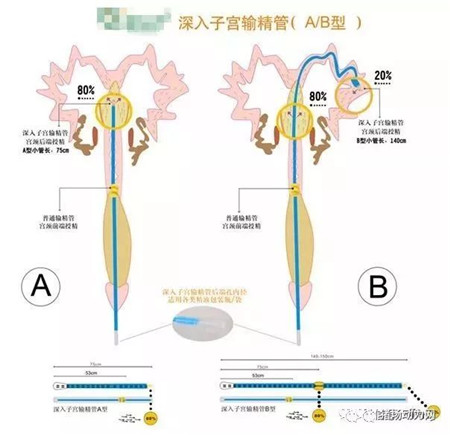 配种注意这个动作，不仅提高配种率，一窝还能多产一头