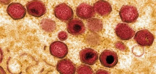 科学家完成非洲猪瘟基因图谱绘制