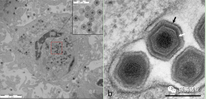 所谓“拔牙”为什么能成功？非洲猪瘟精准清除的理论基础